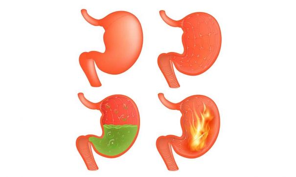 what causes bloating and gas? 