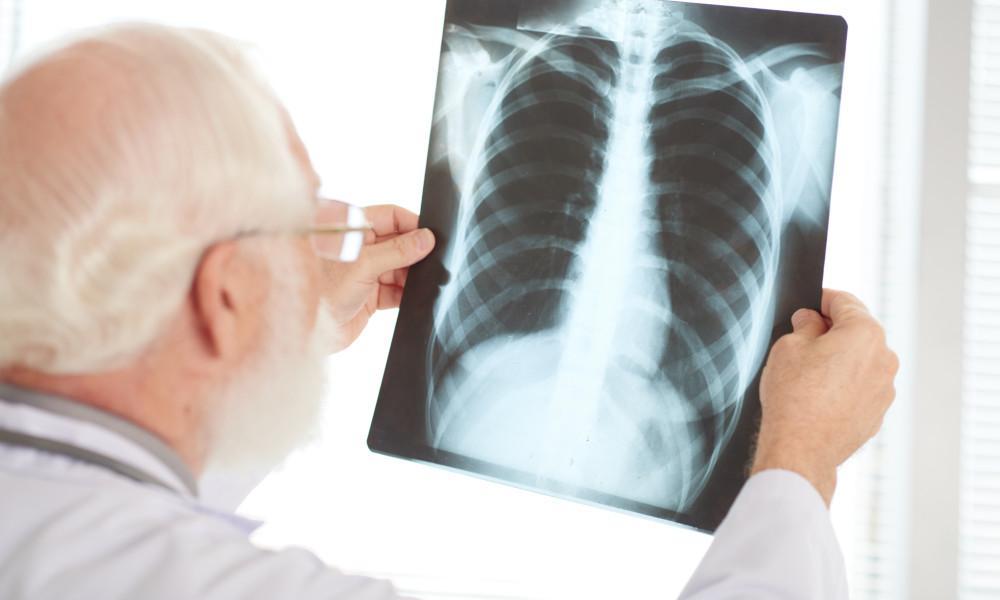 Only A Healthcare Professional Can Diagnose A Lung Issue